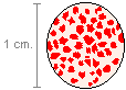 drawing of a blood smear in which the red cells have been agglutinated