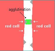 drawing of two red cells agglutinated together by an antibody connecting onto antigens on the surface of red cells